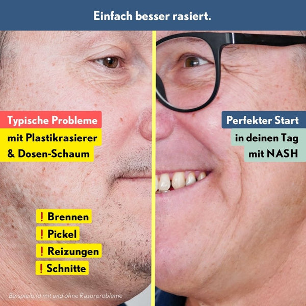 NASH Rasier-Set